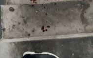 评论丨“我家狗不咬人”引发流血冲突，“犬患”背后首先是管好人
